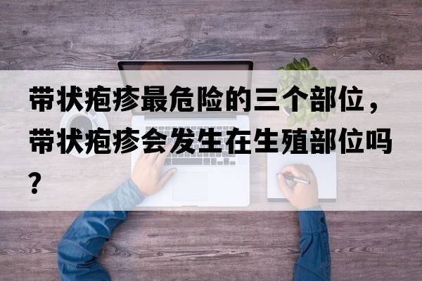 帶狀皰疹最危險的三個(gè)部位，帶狀皰疹會(huì )發(fā)生在生殖部位嗎？